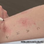 Dog Allergy Symptoms in Humans: Health Guide for Owners