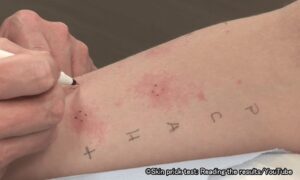 Dog Allergy Symptoms in Humans: Health Guide for Owners