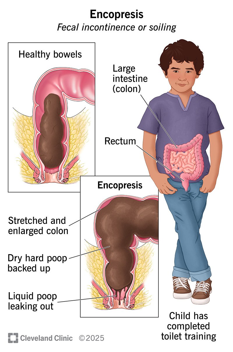 Health and age issues that affect potty habits