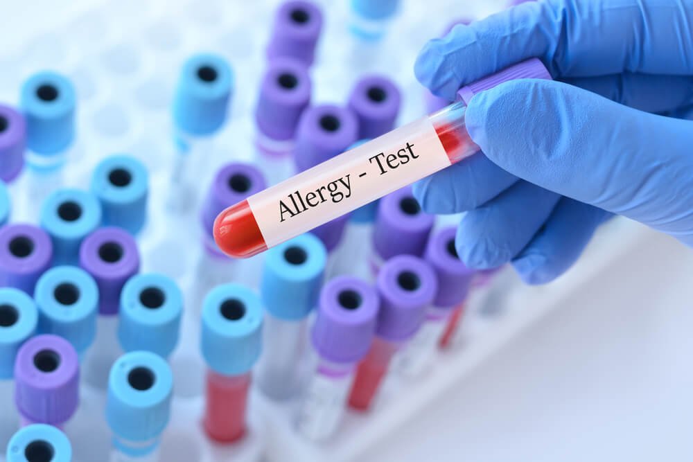 When to consider an allergy test
