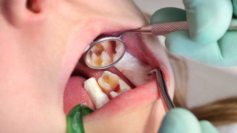 What Happens If You Leave It Untreated