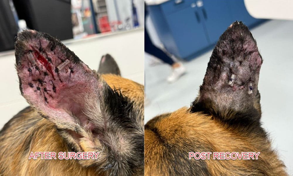 Recovery After Ear Hematoma Treatment