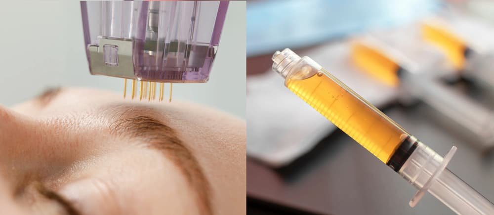 Recovery and ongoing ear care
