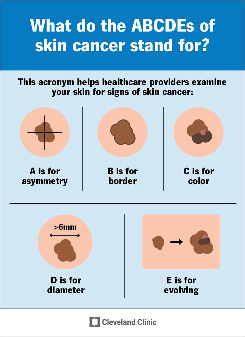 Early signs of skin trouble to watch for