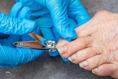Mistake 4: Rough Nail Trims and Paw Care